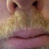 Dwarven Moustache